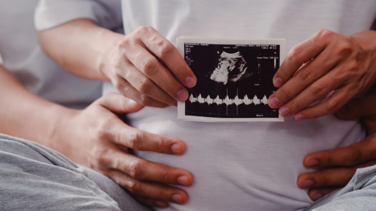 Things to know about Baby Sonograms