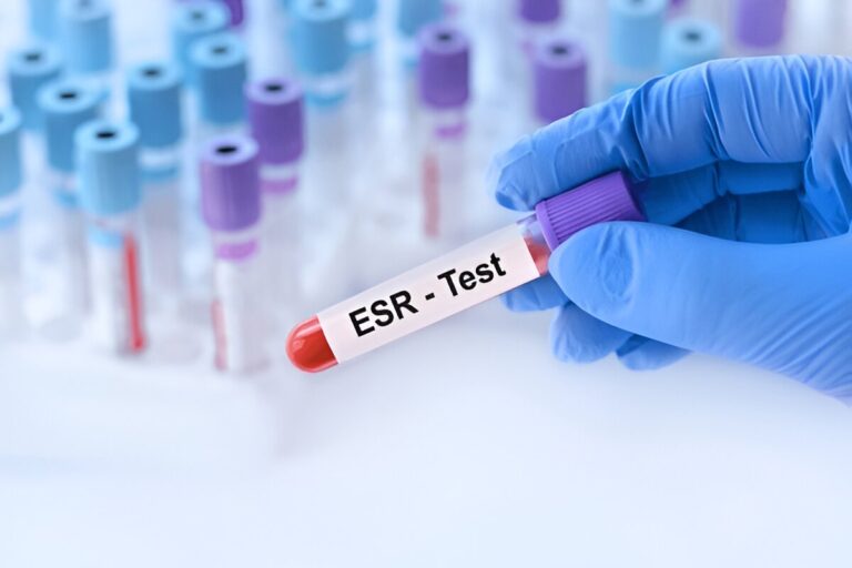 esr test