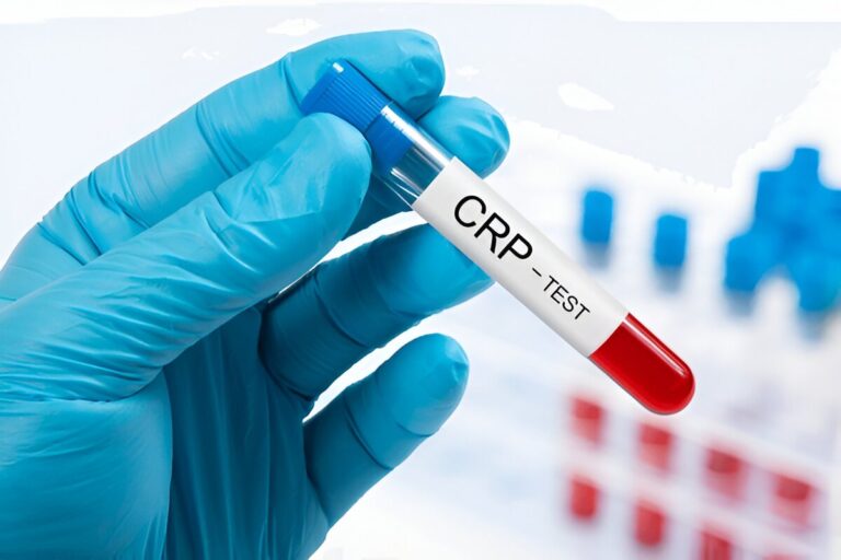 crp test