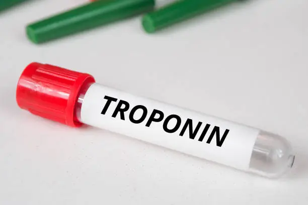 troponin test